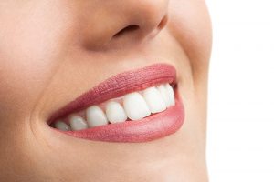 qué son las carillas dentales en Cáceres, qué son las carillas de composite en Cáceres, qué son las carillas de porcelana en Cáceres, cuáles son los tratamientos con carillas dentales en Cáceres, en qué consiste el tratamiento con carillas dentales en Clínica Dental La Chicuela en Cáceres, cuándo se requiere un tratamiento con carillas dentales en Cáceres, beneficios de las carillas dentales en Cáceres