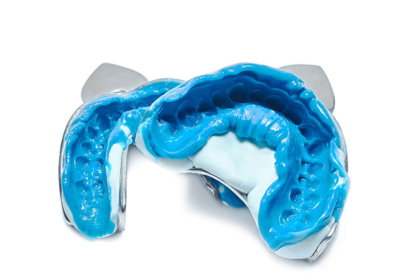 qué es la Ortodoncia en Cáceres, cuáles son los tratamientos de Ortodoncia en Cáceres, cuáles son los tratamientos de Ortodoncia en Clínica Dental La Chicuela en Cáceres, en qué consisten los tratamientos de Ortodoncia en Cáceres, cuáles son los beneficios de los tratamientos de Ortodoncia en Cáceres, cuándo se requiere un tratamiento de Ortodoncia en Cáceres, estudio de Ortodoncia en Cáceres qué es la Ortodoncia en Cáceres, cuáles son los tratamientos de Ortodoncia en Cáceres, cuáles son los tratamientos de Ortodoncia en Clínica Dental La Chicuela en Cáceres, en qué consisten los tratamientos de Ortodoncia en Cáceres, cuáles son los beneficios de los tratamientos de Ortodoncia en Cáceres, cuándo se requiere un tratamiento de Ortodoncia en Cáceres, estudio de Ortodoncia en Cáceres