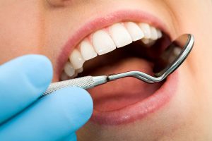 qué es el estudio periodontal en Cáceres, en qué consiste el estudio periodontal en Cáceres, en qué consiste el estudio periodontal en Clínica Dental La Chicuela en Cáceres, cuándo se requiere un estudio periodontal en Cáceres, cuáles son los beneficios de un estudio periodontal en Cáceres