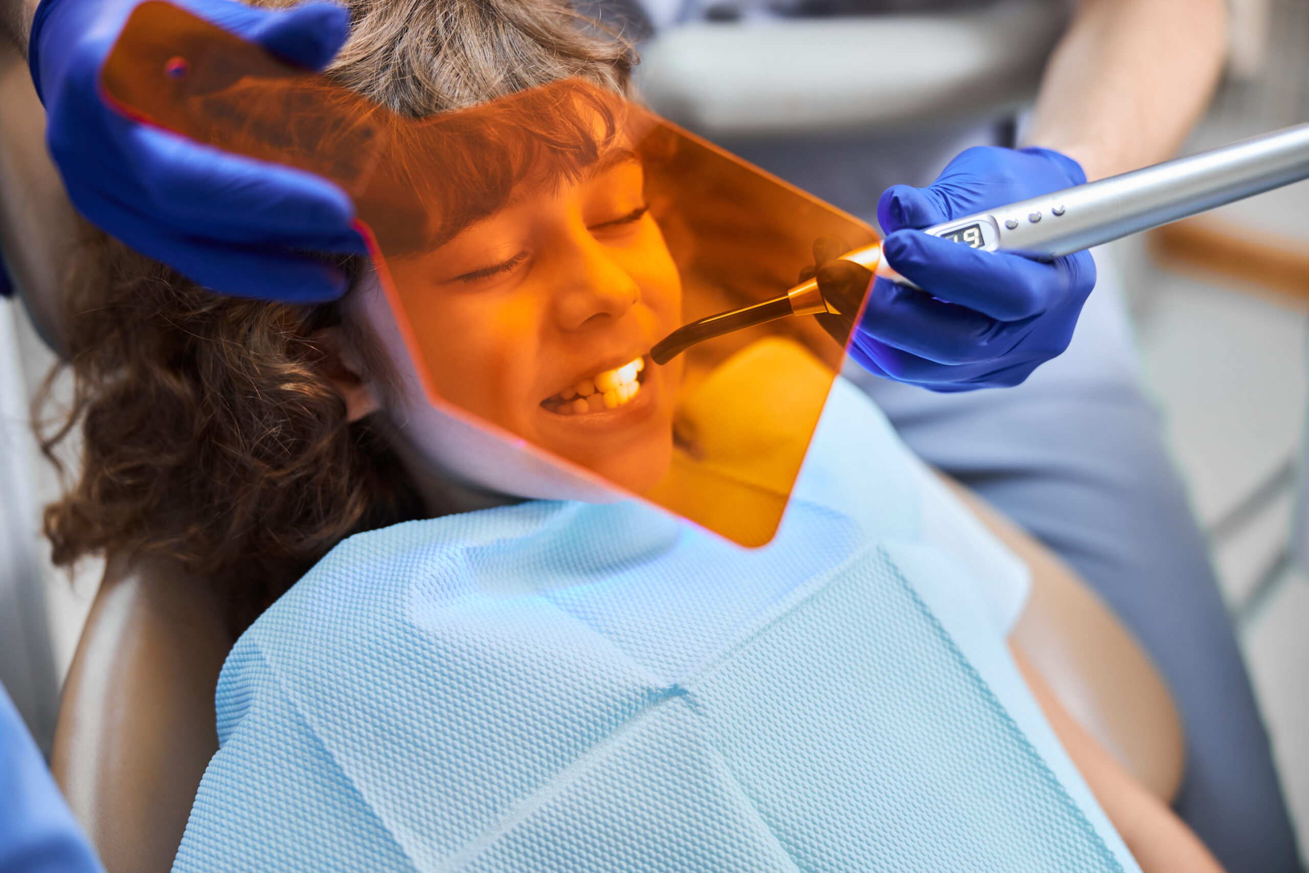 qué es el sellado dental