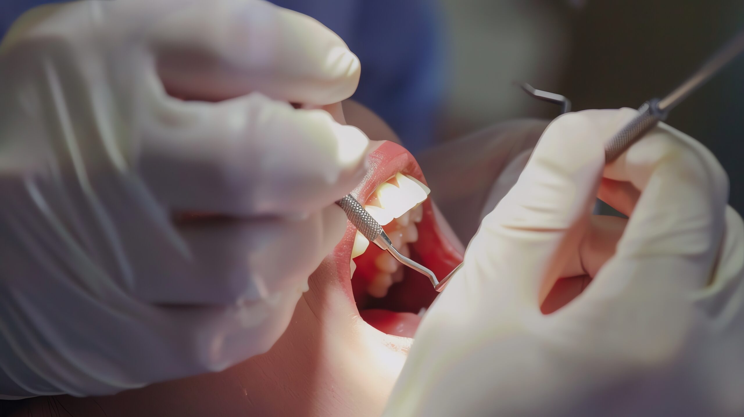 tipos de reconstruccion dental